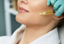 Get Ready for a Younger-Looking You with Radiesse Treatment